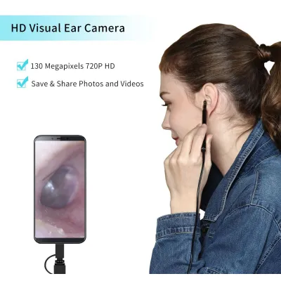 dụng cụ lấy ráy tai có camera dụng cụ lấy ráy tai có camera