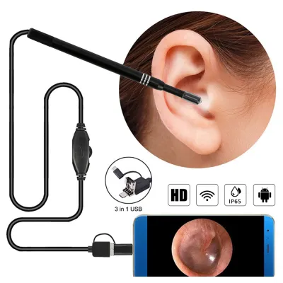 dụng cụ lấy ráy tai có camera - dụng cụ lấy ráy tai nội soi dụng cụ lấy ráy tai có camera - dụng cụ lấy ráy tai nội soi